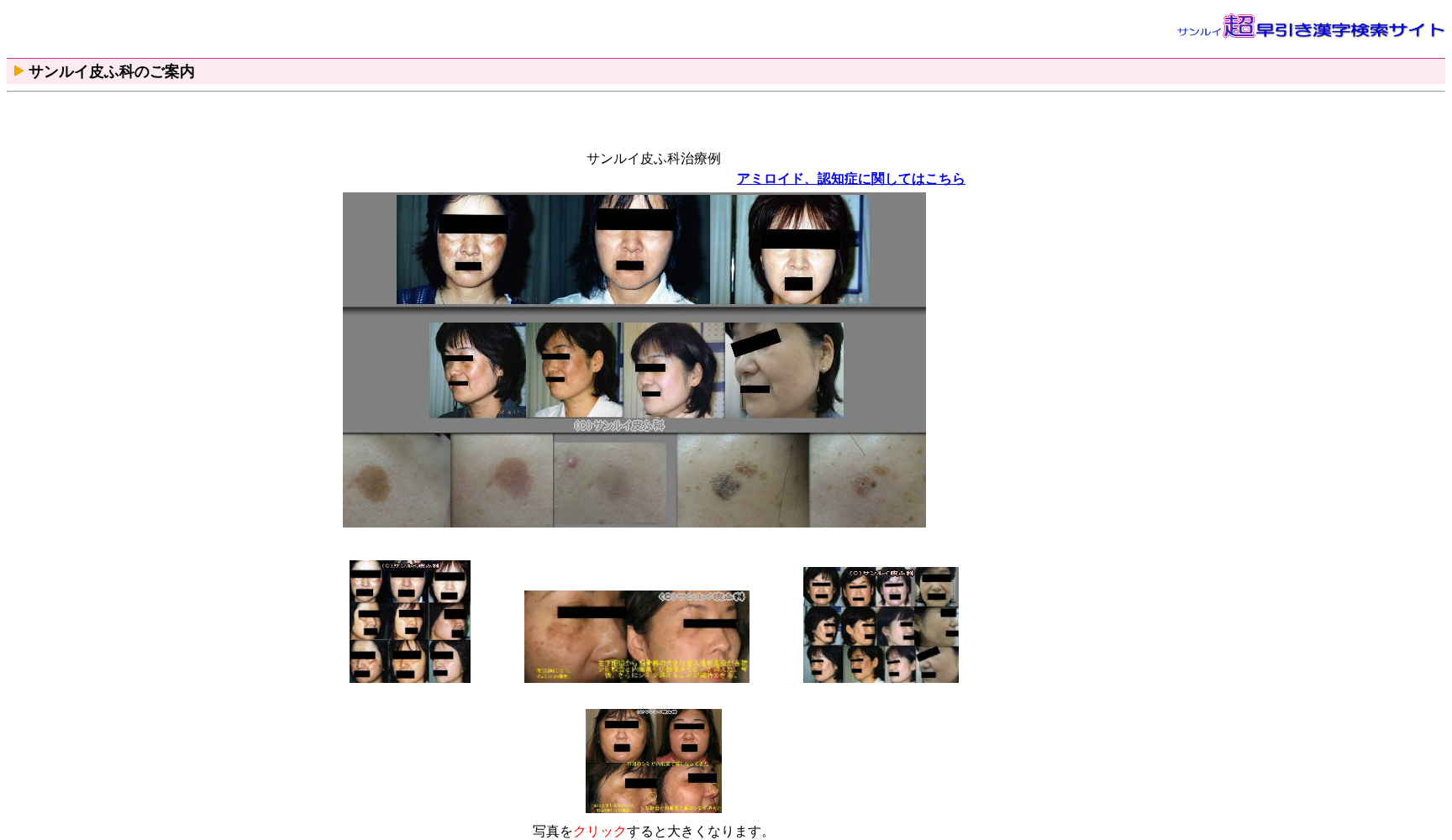 サンルイ皮ふ科